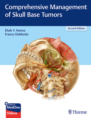 Comprehensive Management of Skull Base Tumors - Hanna, Ehab Y, and Demonte, Franco