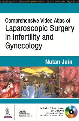 Comprehensive Video Atlas of Laparoscopic Surgery in Infertility and Gynecology - Jain, Nutan