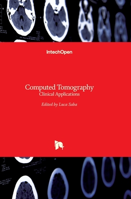 Computed Tomography: Clinical Applications - Saba, Luca (Editor)