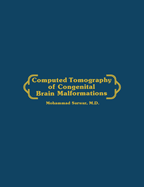 Computed Tomography of Congenital Brain Malformations