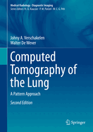 Computed Tomography of the Lung: A Pattern Approach