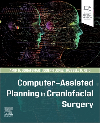 Computer-Assisted Planning in Craniofacial Surgery - Dorafshar, Amir H, Facs, Faap, and Lopez, Joseph, MD, and Reid, Russell R, MD, PhD