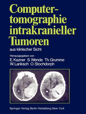 Computertomographie Intrakranieller Tumoren Aus Klinischer Sicht - Kazner, E (Revised by), and Bradac, G B (Revised by), and Wende, S (Revised by)