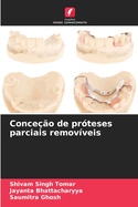 Conce??o de pr?teses parciais remov?veis