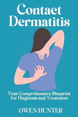 Contact Dermatitis: Your Comprehensive Blueprint for Diagnosis and Treatment - Hunter, Owen