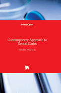 Contemporary Approach to Dental Caries