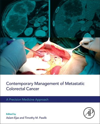 Contemporary Management of Metastatic Colorectal Cancer: A Precision Medicine Approach - Ejaz, Aslam (Editor), and Pawlik, Timothy M (Editor)