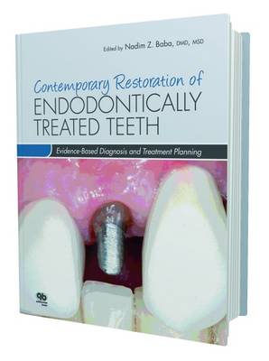 Contemporary Restoration of Endodontically Treated Teeth: Evidence-Based Diagnosis and Treatment Planning - Baba, Nadim Z