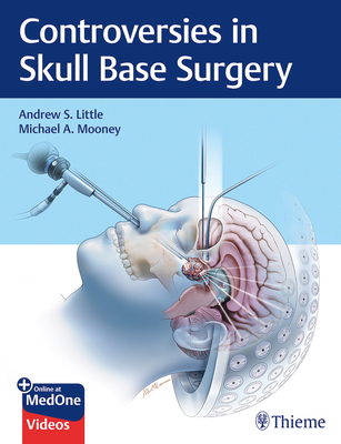 Controversies in Skull Base Surgery - Little, Andrew S, and Mooney, Michael A