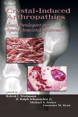 Crystal-Induced Arthropathies: Gout, Pseudogout and Apatite-Associated Syndromes - Wortmann, Robert L (Editor), and Schumacher, H Ralph (Editor), and Becker, Michael A (Editor)