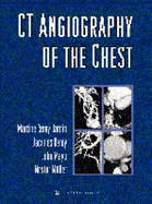 CT Angiography of the Chest