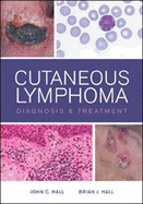 Cutaneous Lymphoma Diagnosis and Treatment