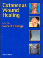 Cutaneous Wound Healing - Falanga, Vincent, MD, Facp (Editor)