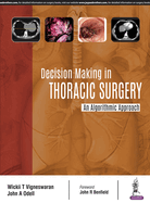 Decision Making in Thoracic Surgery: An Algorithmic Approach