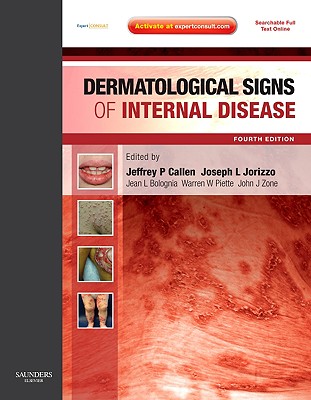 Dermatological Signs of Internal Disease - Jorizzo, Joseph L, MD, and Piette, Warren, MD, and Zone, John J, MD