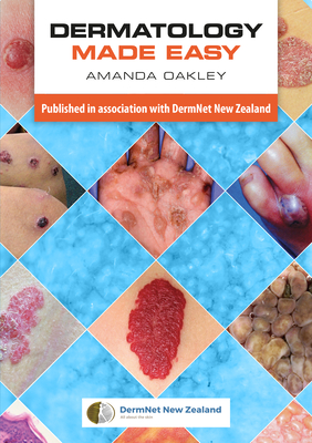 Dermatology Made Easy - Oakley, Amanda, and DermNet NZ (Photographer)