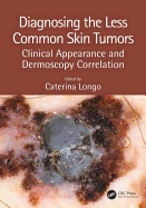 Diagnosing the Less Common Skin Tumors: Clinical Appearance and Dermoscopy Correlation