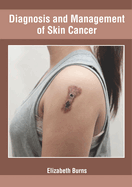 Diagnosis and Management of Skin Cancer