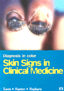 Diagnosis in Color: Skin Signs in Clinical Medicine