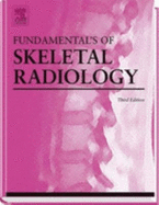 Diagnosis of Diseases of the Breast - Fu, Yao S, MD, and Bassett, Lawrence W, MD, and Jackson, Valerie P, MD