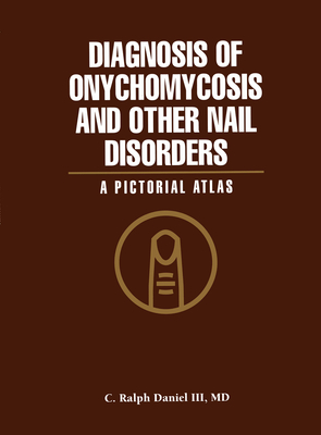 Diagnosis of Onychomycosis and Other Nail Disorders: A Pictorial Atlas - Daniel, C Ralph III