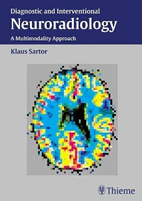 Diagnostic and Interventional Neuroradiology: A Multimodality Approach - Sartor, Klaus, and Albrecht, Georg, and Atzor, K.-R.