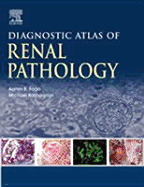 Diagnostic Atlas of Renal Pathology: A Companion to Brenner and Rector's the Kidney