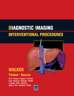 Diagnostic Imaging: Interventional Procedures