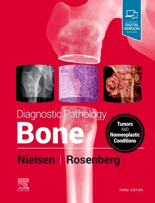 Diagnostic Pathology: Bone - Nielsen, G Petur, MD, and Rosenberg, Andrew E, MD