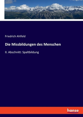 Die Missbildungen des Menschen: II. Abschnitt: Spaltbildung - Ahlfeld, Friedrich