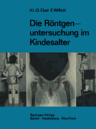 Die Rontgenuntersuchung Im Kindesalter: Technik Und Indikation