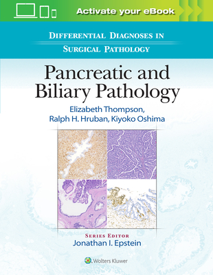 Differential Diagnoses in Surgical Pathology: Pancreatic and Biliary Pathology - Thompson, Elizabeth Dell, MD, PhD, and Hruban, Ralph H, MD, and Oshima, Kiyoko