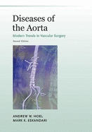 Diseases of the Aorta: Modern Trends in Vascular Surgery