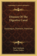 Diseases of the Digestive Canal: Esophagus, Stomach, Intestines