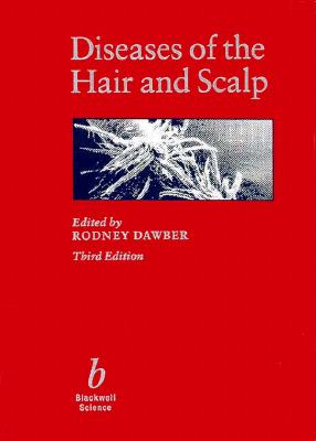 Diseases of the Hair and Scalp - Dawber, Rodney P R (Editor)