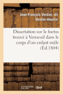 Dissertation Sur Le Foetus Trouv? ? Verneuil Dans Le Corps d'Un Enfant M?le