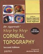Dr Agarwal's Step by Step Corneal Topography