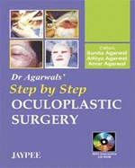 Dr. Agarwal's Step by Step Oculoplastic Surgery