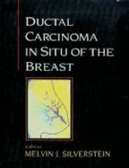 Ductal Carcinoma "In Situ" of the Breast