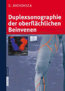 Duplexsonographie Der Oberflchlichen Beinvenen