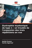 Dystrophie myotonique de type 1: un trouble de l'expansion des trois r?p?titions en vue