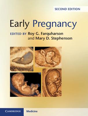 Early Pregnancy - Farquharson, Roy G. (Editor), and Stephenson, Mary D. (Editor)