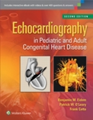 Echocardiography in Pediatric and Adult Congenital Heart Disease - Eidem, Benjamin W, MD, Facc, and O'Leary, Patrick W, MD, Facc, and Cetta, Frank, MD, Facc