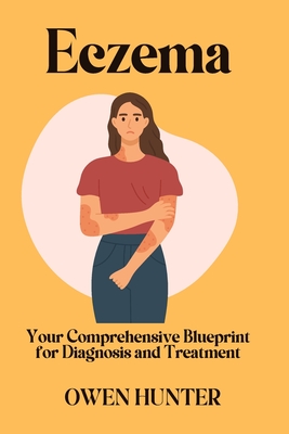 Eczema: Your Comprehensive Blueprint for Diagnosis and Treatment - Hunter, Owen