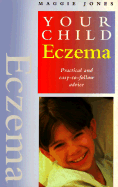 Eczema - Jones, Maggie