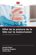 Effet de la posture de la tte sur la malocclusion