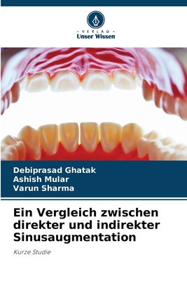 Ein Vergleich zwischen direkter und indirekter Sinusaugmentation - Ghatak, Debiprasad, and Mular, Ashish, and Sharma, Varun