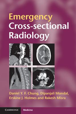Emergency Cross-Sectional Radiology - Chung, Daniel Y F, Dr., and Mondal, Dipanjali, and Holmes, Erskine J