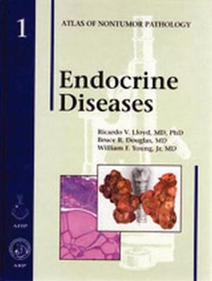 Endocrine Diseases - Lloyd, Ricardo V