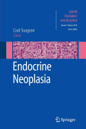 Endocrine Neoplasia